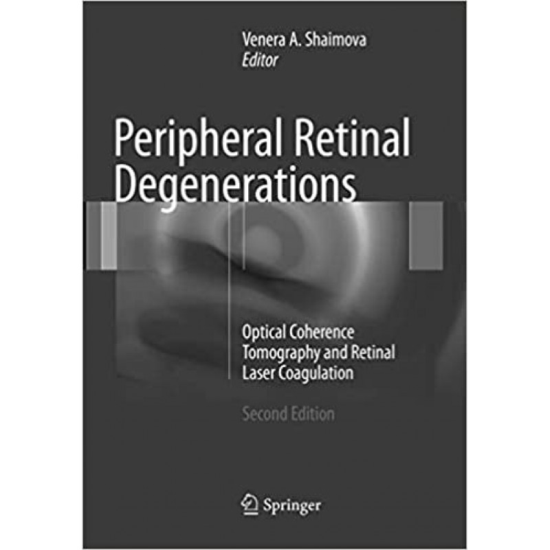 Peripheral Retinal Degenerations