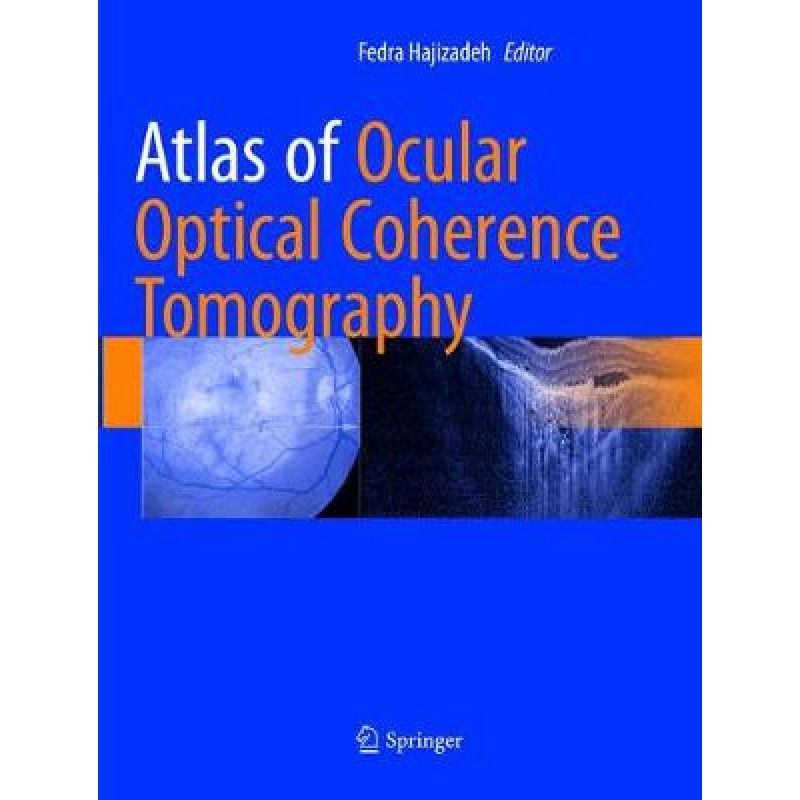 Atlas of Ocular Optical Coherence Tomography