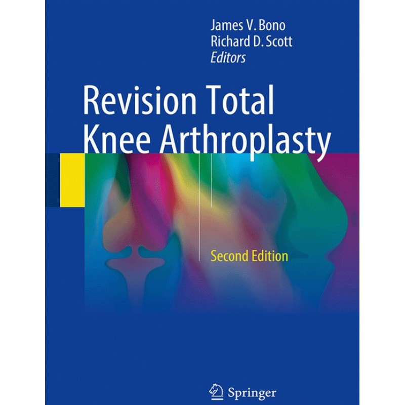 Revision Total Knee Arthroplasty