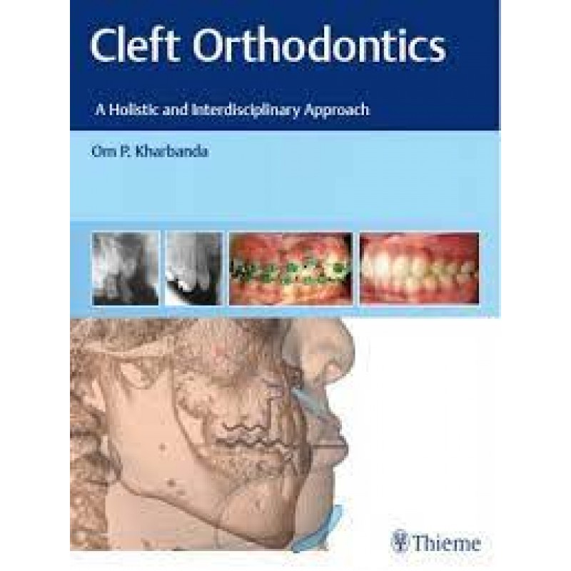  Cleft Orthodontics A Holistic and Interdisciplinary Approach