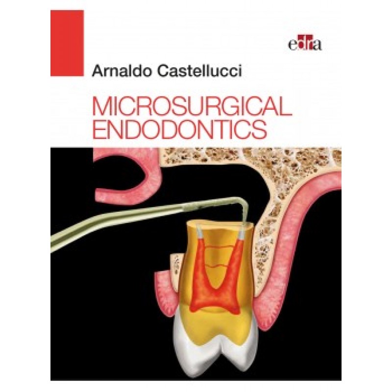 Microsurgical Endodontics