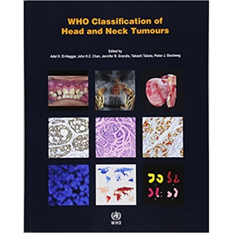 WHO Classification of Head and Neck Tumours WHO Classification of Tumours, 4th Edition, Volume 9