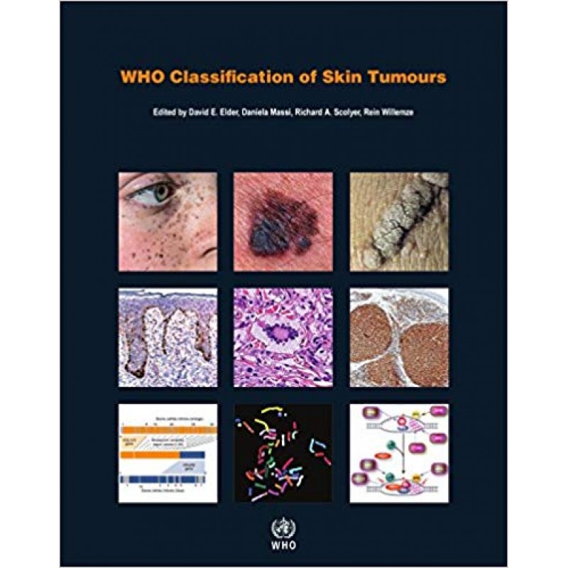 WHO Classification of Skin Tumours WHO Classification of Tumours, 4th Edition, Volume 11