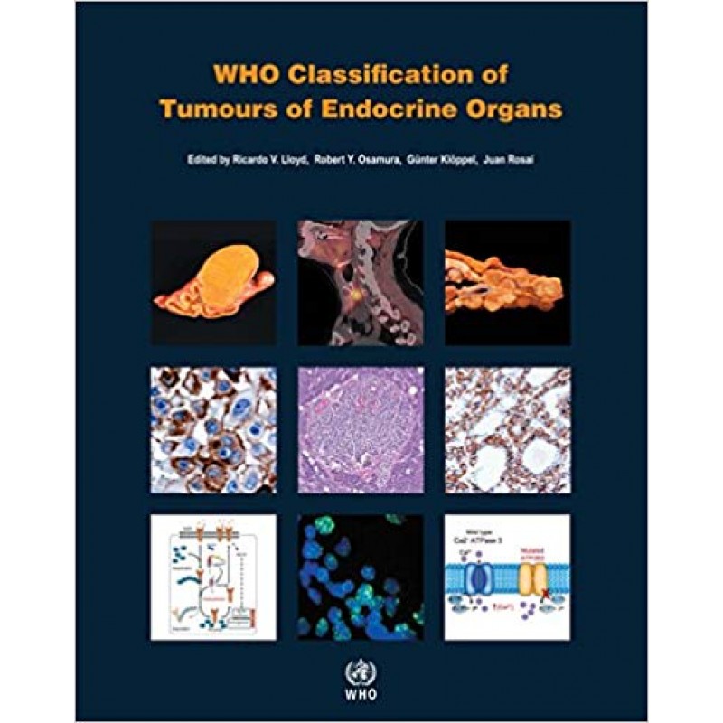 WHO Classification of Tumours of Endocrine Organs WHO Classification of Tumours, 4th Edition, Volume 10