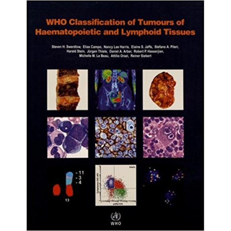 WHO Classification of Tumours of Haematopoietic and Lymphoid Tissues WHO Classification of Tumours, Revised 4th Edition, Volume 2