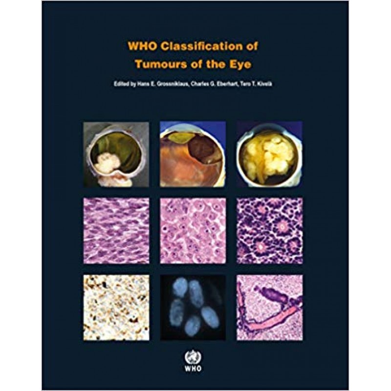 WHO Classification of Tumours of the Eye WHO Classification of Tumours, 4th Edition, Volume 12