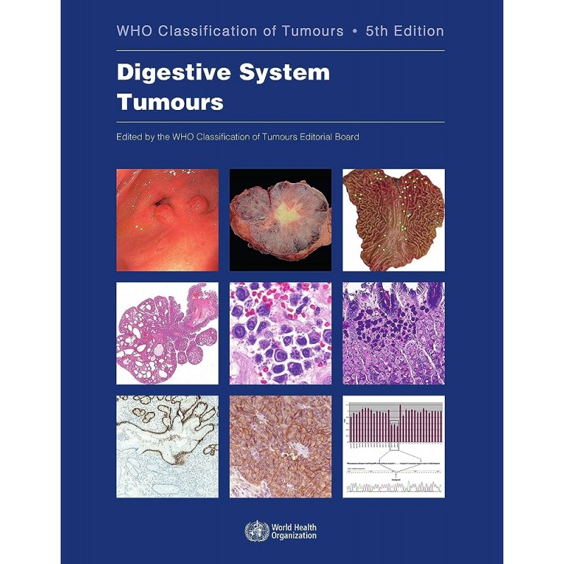 Digestive System Tumours WHO Classification of Tumours, 5th Edition, Volume 1