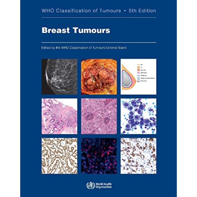 Breast Tumours WHO Classification of Tumours, 5th Edition, Volume 2