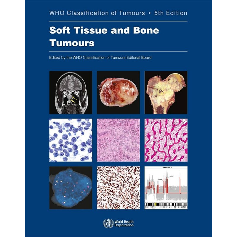 Soft Tissue and Bone Tumours WHO Classification of Tumours, 5th Edition, Volume 3