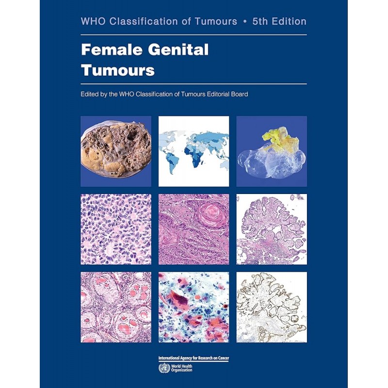 Female Genital Tumours WHO Classification of Tumours, 5th Edition, Volume 4