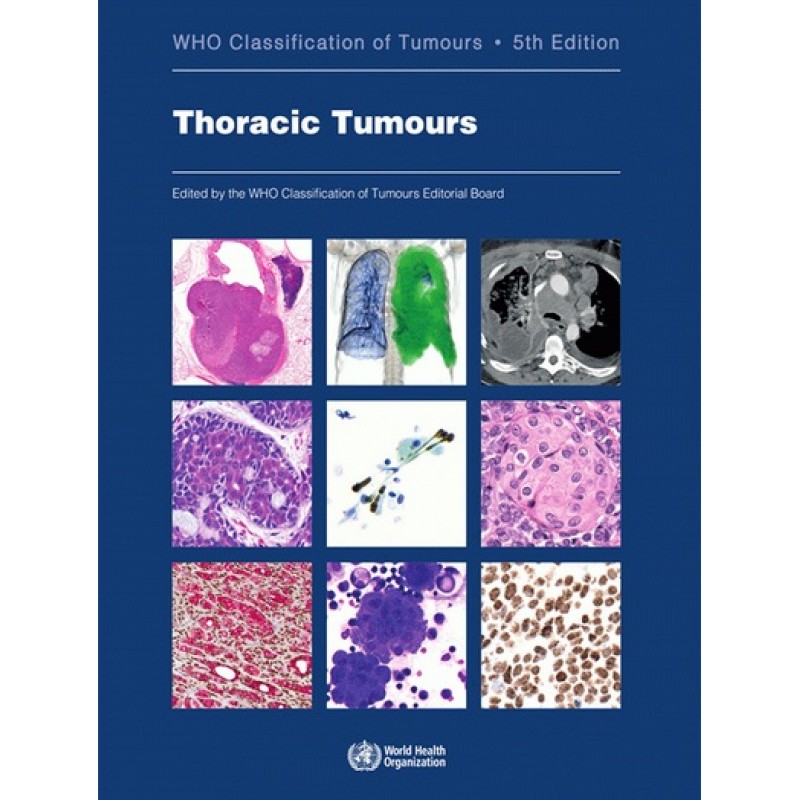 WHO Classification of Tumours: Thoracic Tumours, 5E