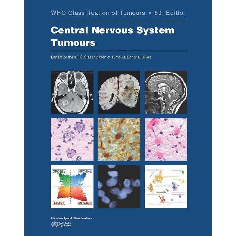 Central Nervous System Tumours WHO Classification of Tumours, 5th Edition, Volume 6