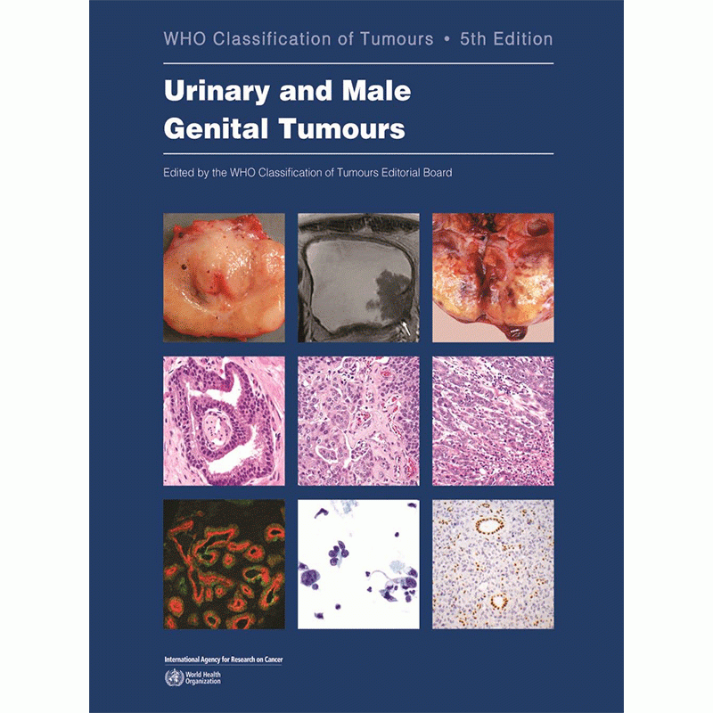 WHO Classification of Tumours: Urinary and Male Genital Tumours, 5th Edition