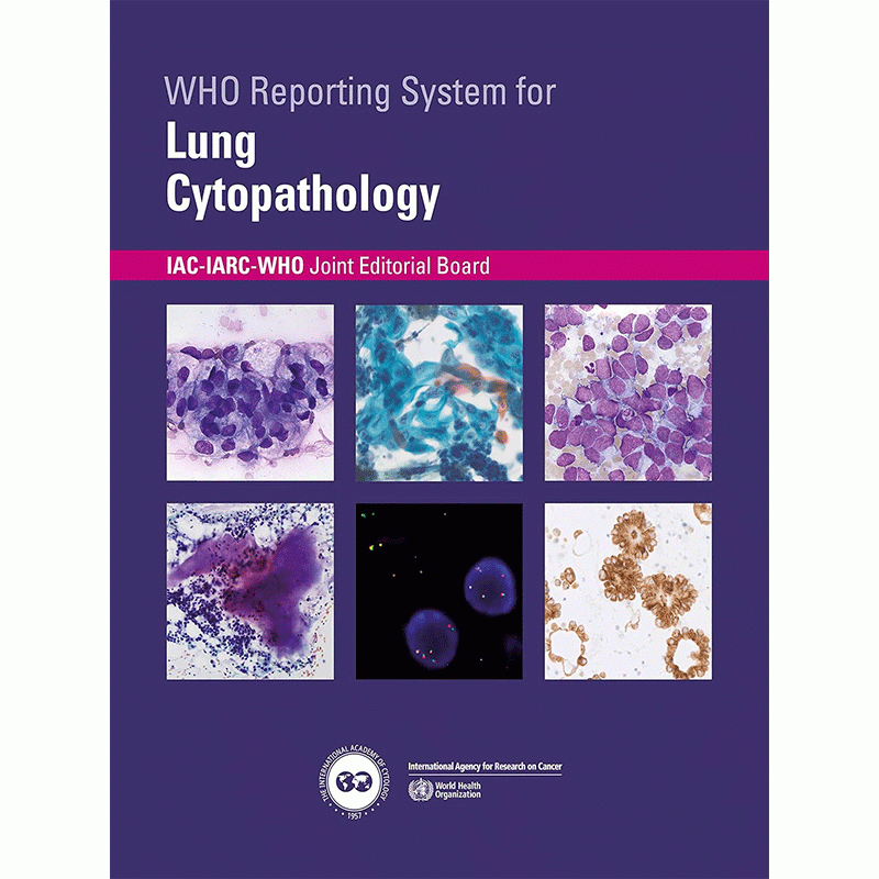 WHO Reporting System for Lung Cytopathology IAC-IARC-WHO