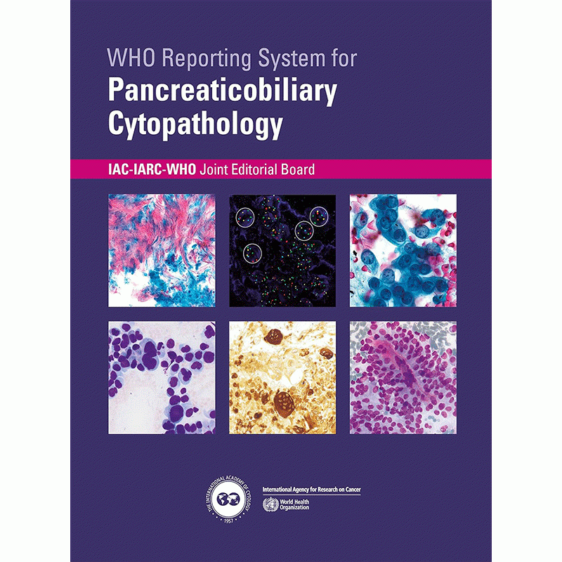 WHO Reporting System for Pancreaticobiliary Cytopathology IAC-IARC-WHO