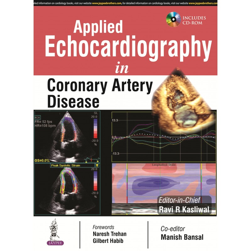  Applied Echocardiography in Coronary Artery Disease, RR Kasliwal