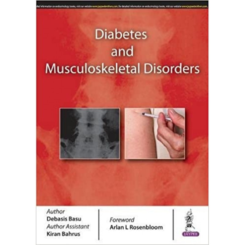 Diabetes and Musculoskeletal Disorders