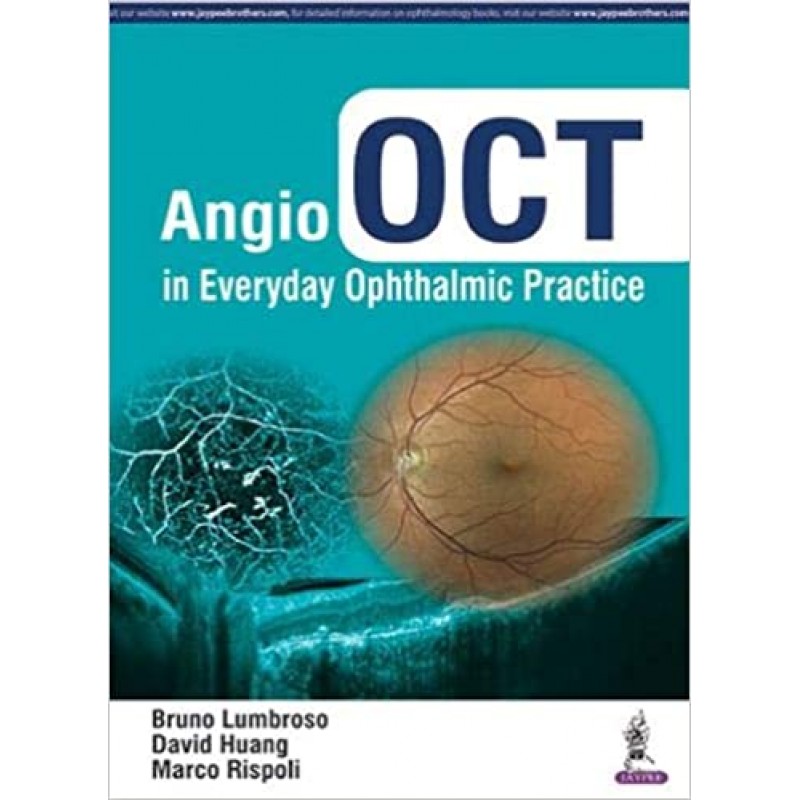 Angio OCT in Everyday Ophthalmic Practice