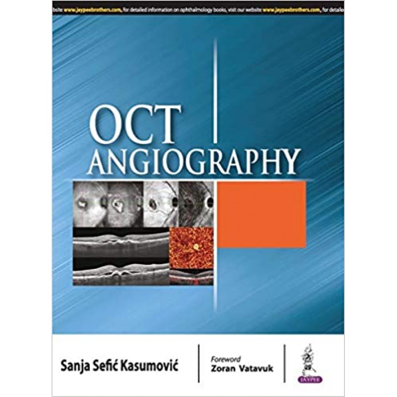 OCT Angiography 1st Edition