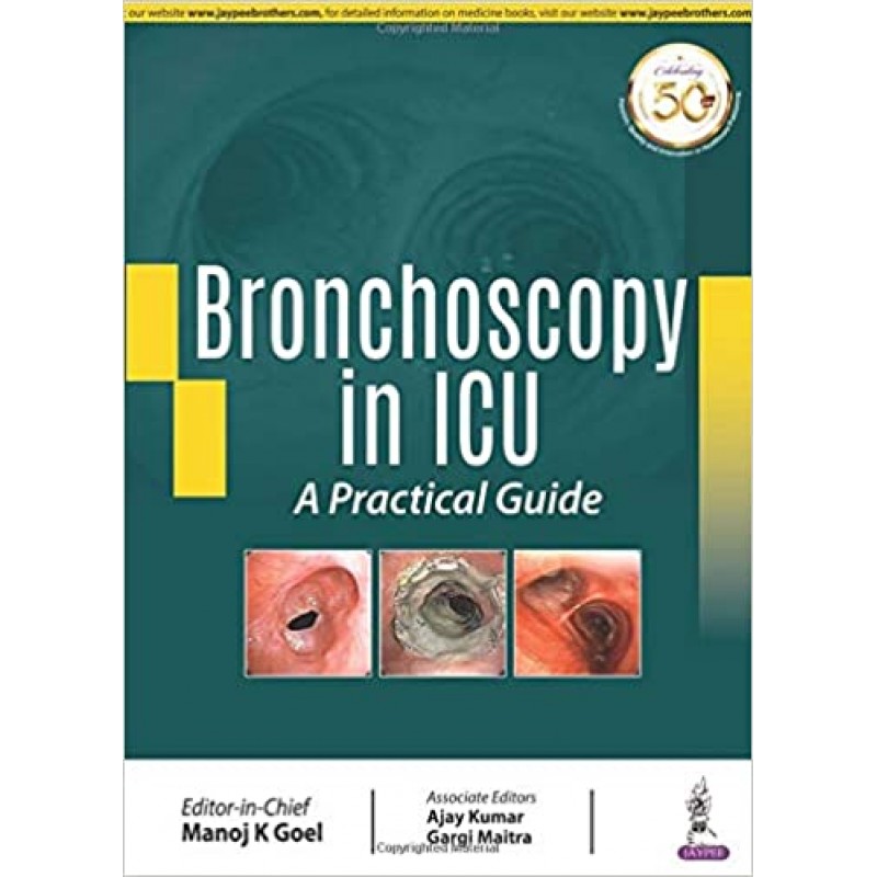  Bronchoscopy in ICU: A Practical Guide