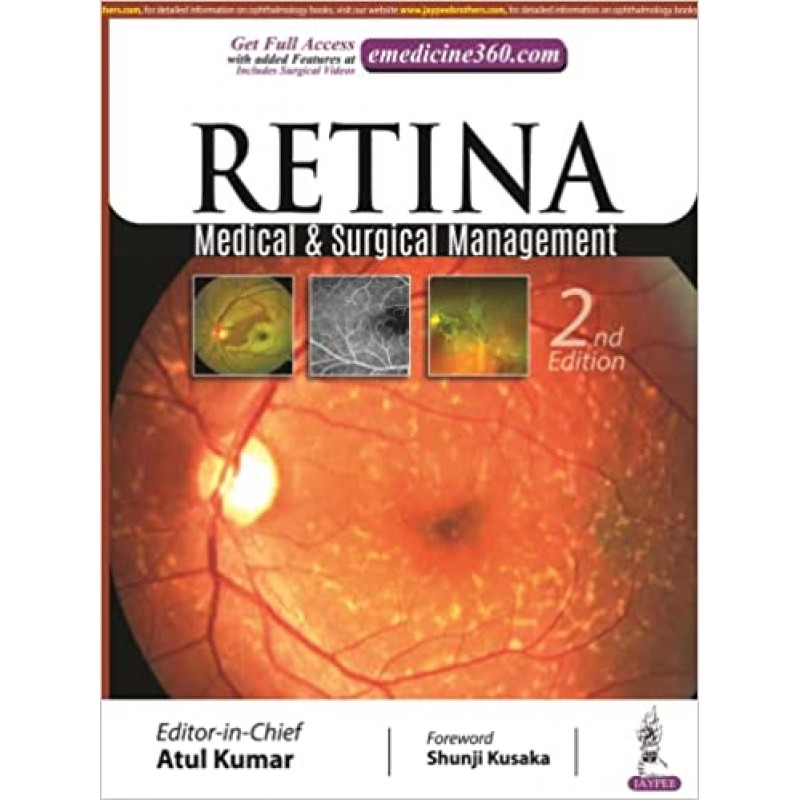 Retina: Medical & Surgical Management