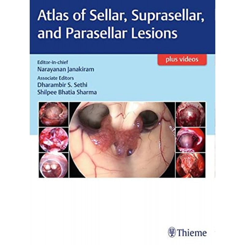 Atlas of Sellar, Suprasellar, and Parasellar Lesions