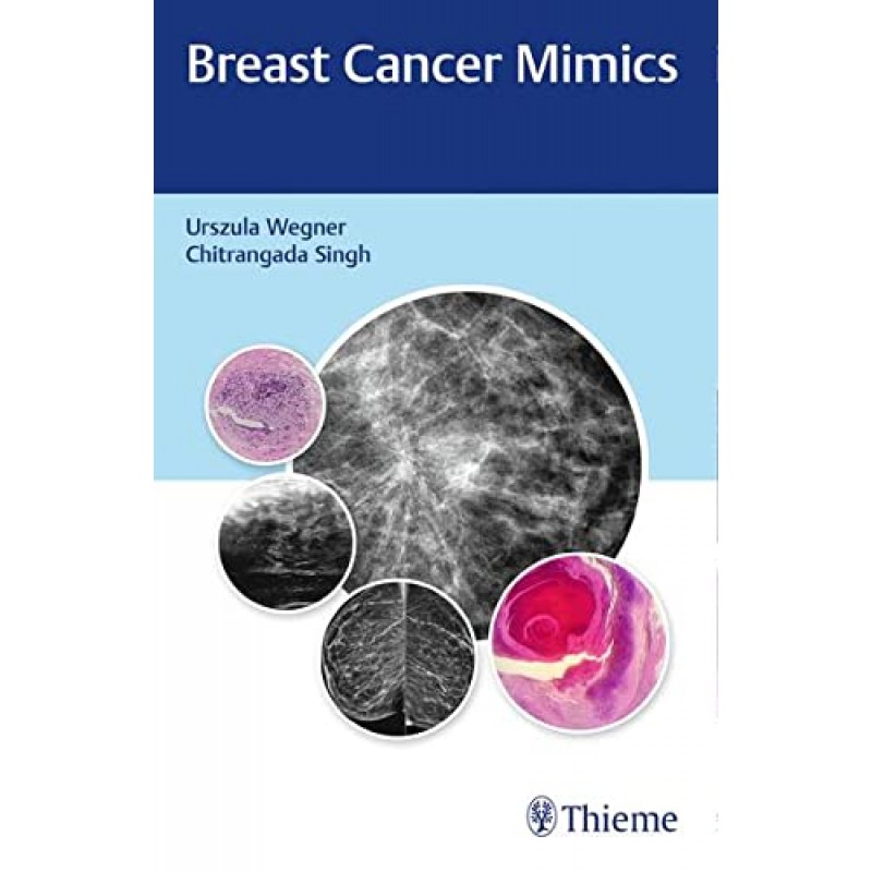 Breast Cancer Mimics 