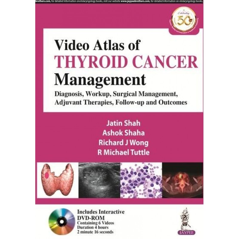  Video Atlas of Thyroid Cancer Management