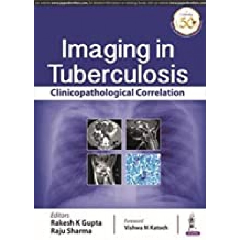 Imaging in Tuberculosis - Clinicopathological Correlation