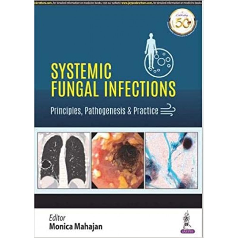 Systemic Fungal Infections: Principles, Pathogenesis & Practice