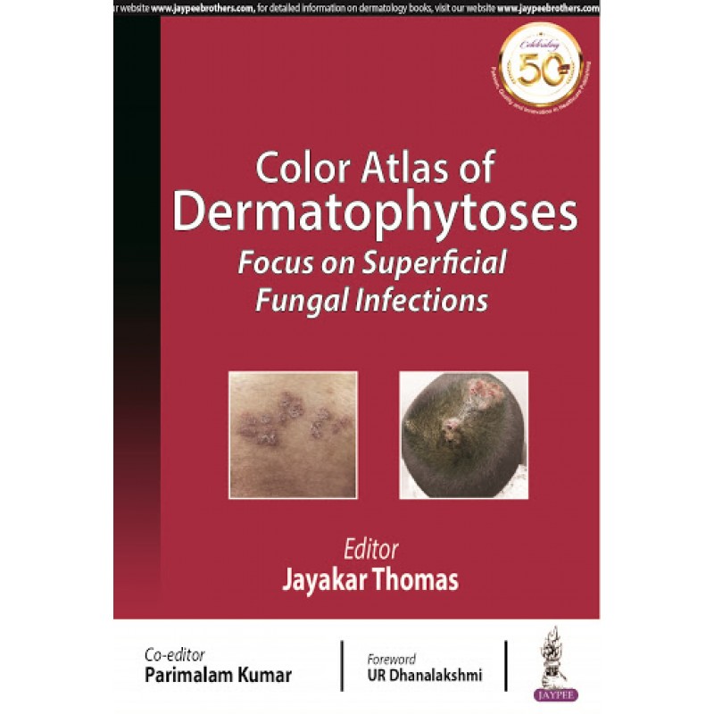 Color Atlas of Dermatophytoses