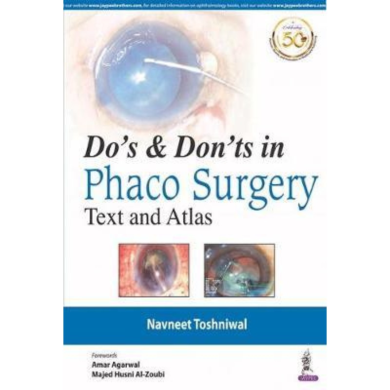  Do's & Dont's in Phaco Surgery