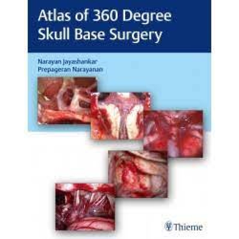 Atlas of 360 Degree Skull Base Surgery 