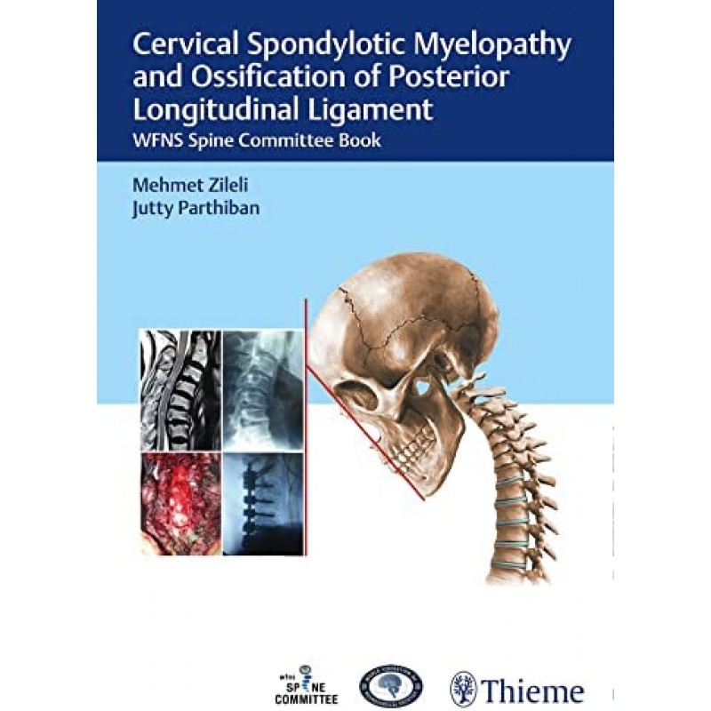  Cervical Spondylotic Myelopathy and Ossification of Posterior Longitudinal Ligament WFNS Spine Committee Book