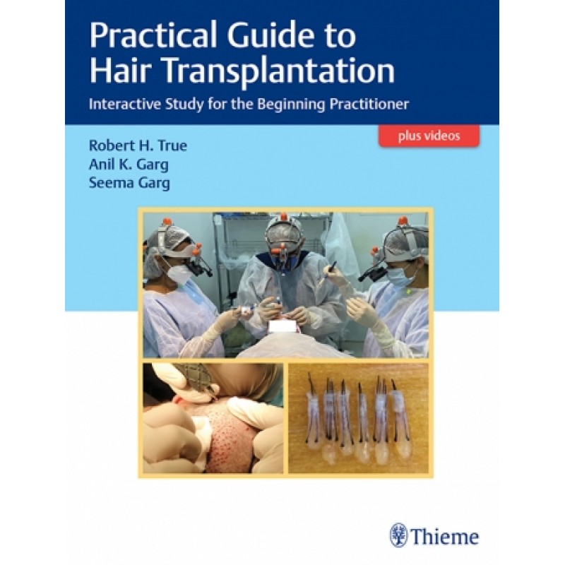  Practical Guide to Hair Transplantation Interactive Study for the Beginning Practitioner