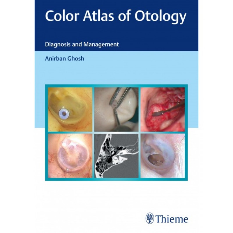  Color Atlas of Otology Diagnosis and Management