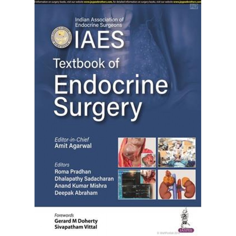 Textbook of Endocrine Surgery