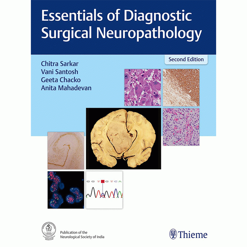 Essentials of Diagnostic Surgical Neuropathology, 2nd Edition