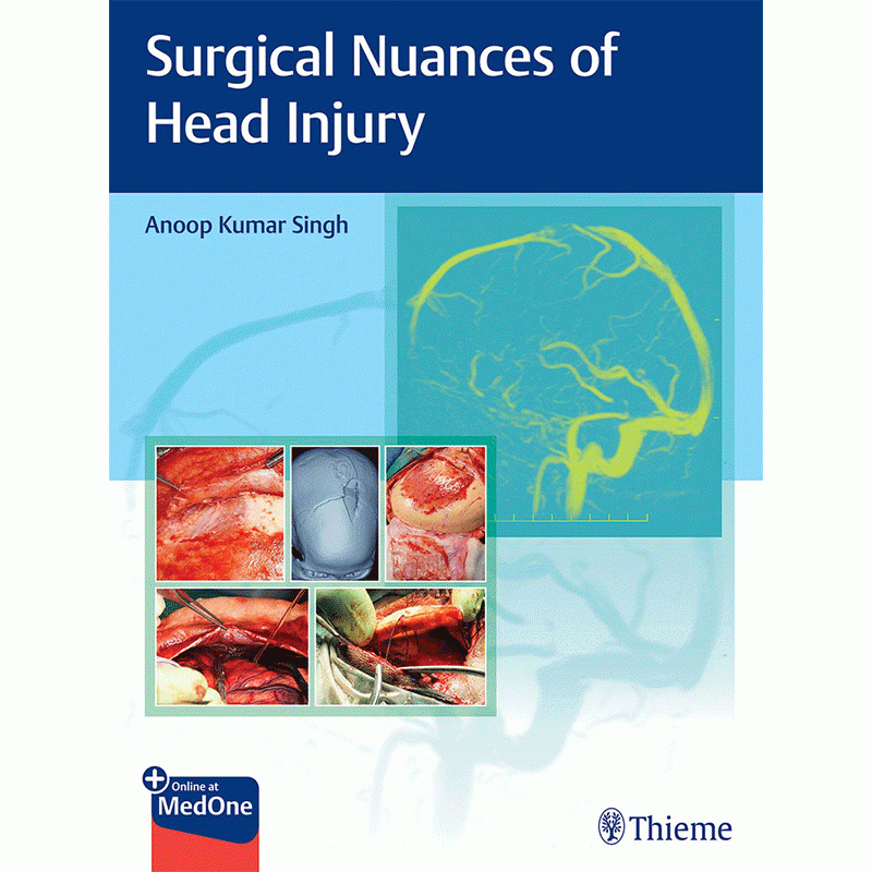 Surgical Nuances of Head Injury