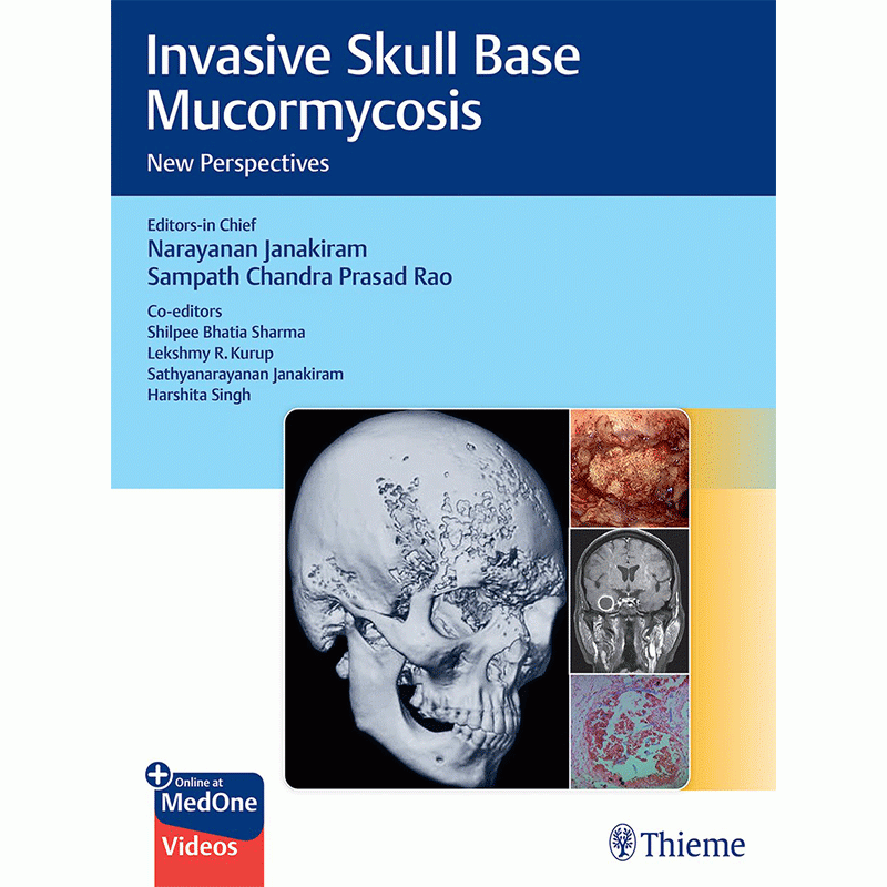 Invasive Skull Base Mucormycosis: New Perspectives