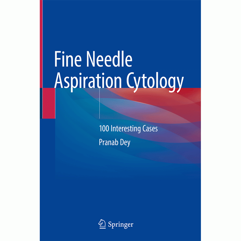 Fine Needle Aspiration Cytology: 100 Interesting Cases