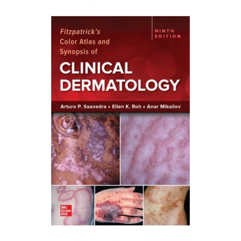 Fitzpatrick’s Color Atlas and Synopsis of Clinical Dermatology, 9th Edition