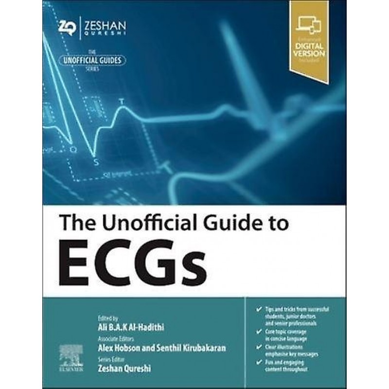 The Unofficial Guide to ECGs