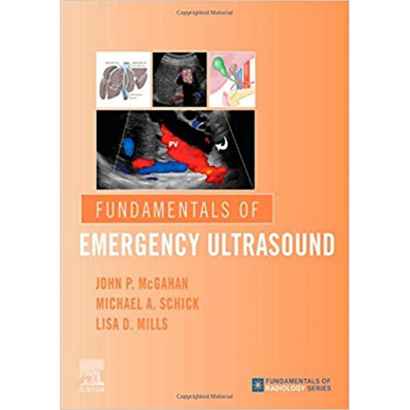 Fundamentals of Emergency Ultrasound