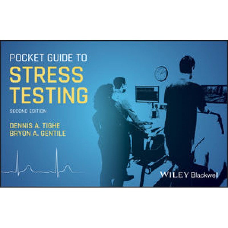 Pocket Guide to Stress Testing, 2nd Edition