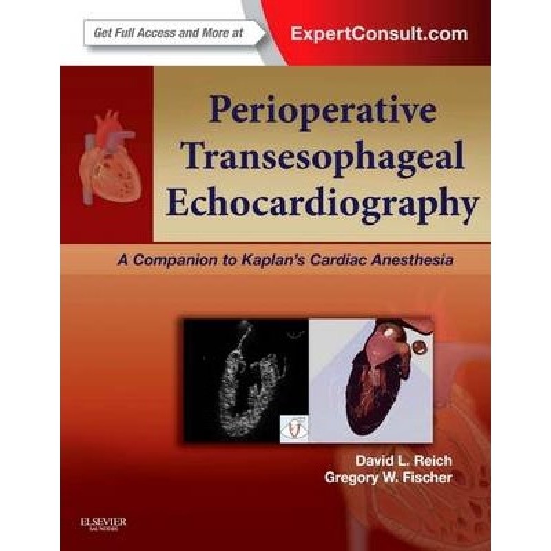 Perioperative Transesophageal Echocardiography