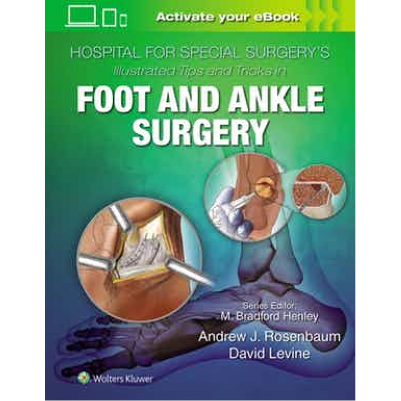 Hospital for Special Surgery's Illustrated Tips and Tricks in Foot and Ankle Surgery 1st edition