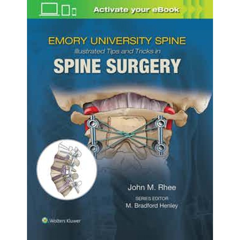 Emory's Illustrated Tips and Tricks in Spine Surgery 1st edition