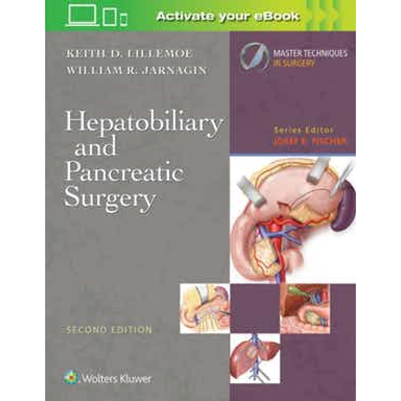 Master Techniques in Surgery: Hepatobiliary and Pancreatic Surgery 2nd edition