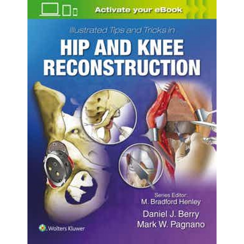 Illustrated Tips and Tricks in Hip and Knee Reconstructive and Replacement Surgery 1st edition